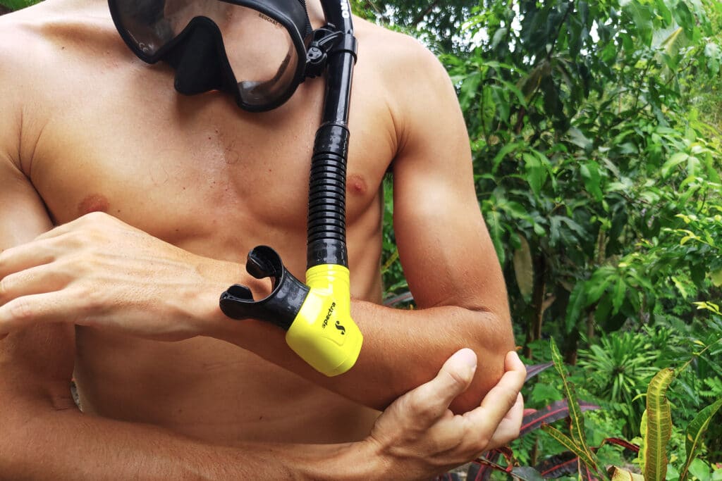 Why is Decompression Sickness Called the Bends?